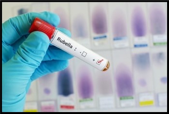 Image: A close up image of a hand covered with a blue latex glove is holding a test-tube with a red cap.  The test-tube has the word “Rubella” typed on it.  There are two boxes on the label, one with a minus sign to the left of it, and the other with a plus sign to the left of it.  There is a red check mark in the box with the plus sign next to it. 