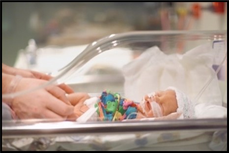 Image: A small baby is shown with tubes in its nose and a multi-colored cloth bandage around its body.  The baby is laying in a clear plastic enclosure.  There are two adult hands touching the baby’s legs.