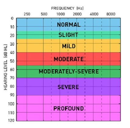 Audiogram chart with dB HL on the vertical axis, Hz on the horizontal axis (250–8000 Hz), color-coded for degrees of hearing.