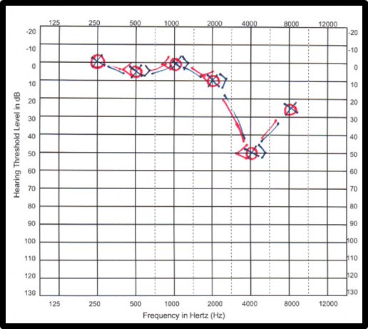 Audiogram with Hearing Threshold Level in dB on Y-axis and Frequency in Hertz on x-axis with red circles and blue X markings